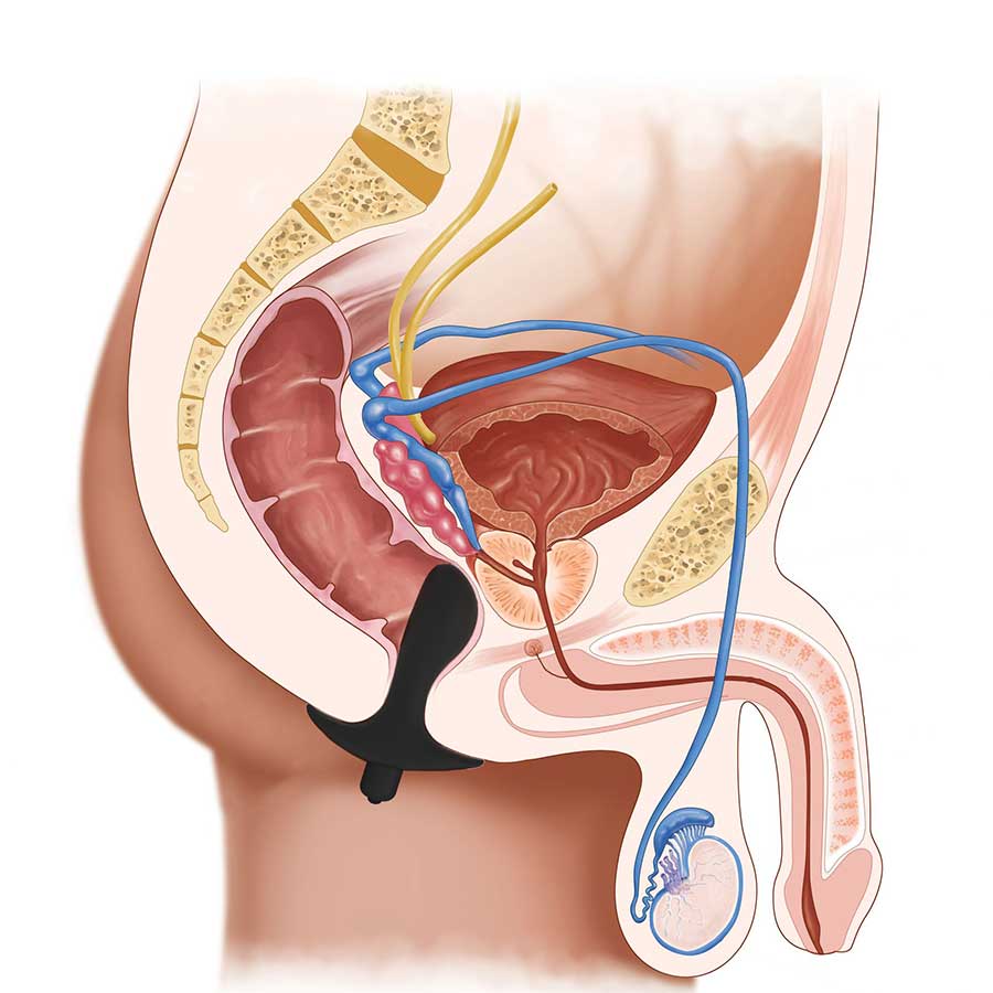 Lynk Pleasure - Vendita all'ingrosso Sex toy - Massaggiatore prostatico vibrante in silicone Starter2