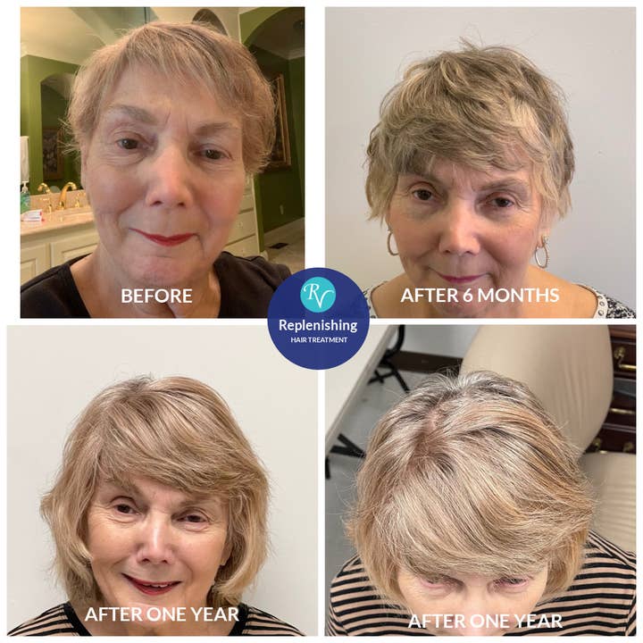 RemeVerse - Wholesale Hair Serum - Replenishing Hair Serum with Redensyl®5