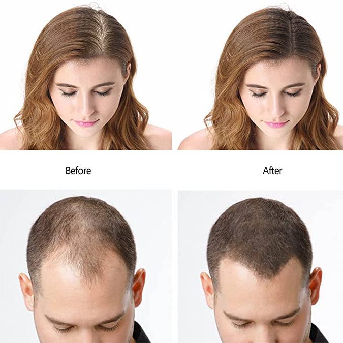 Pirology Botanics - Wholesale Hair Thinning/Loss Treatment - NATURAL KERATIN HAIR FIBERS DARK BROWN 27.5 G