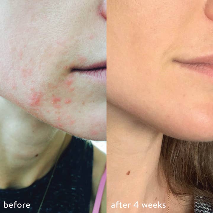 LUMION skin - Wholesale Face & Body Mist/Water - Miracle Mist with HOCL + Oxygen3