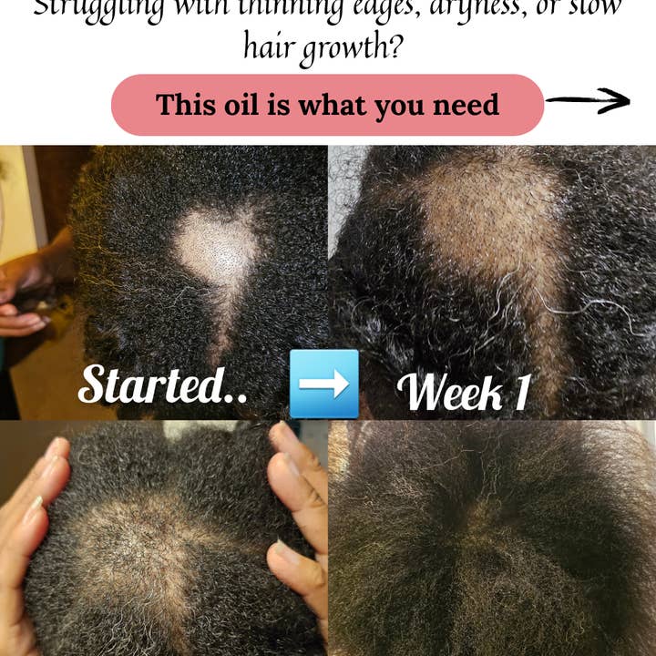 Queen's Abundance Krown - Wholesale Hair Oil - Nourishing Growth Rosemary Hair Oil | Strengthen, Hydrate & Promote Healthy Hair 4oz11