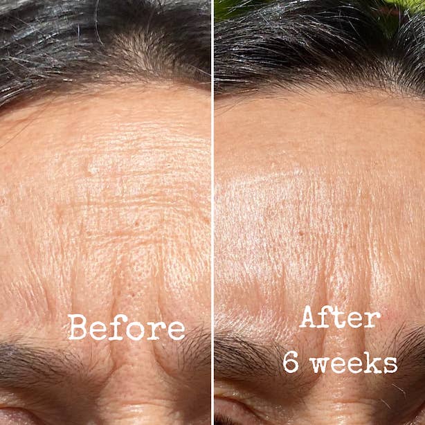 PureCeuticals Skin Care - Wholesale Facial Serum/Concentrate - Retinol & Lactic Resurfacing Treatment