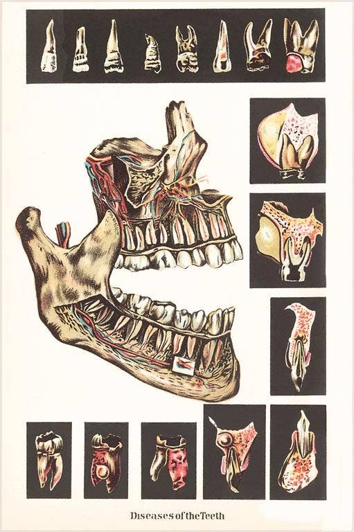 Found Image Press – wholesale Postcard – Postcard AY-31 Diseases of the Teeth0