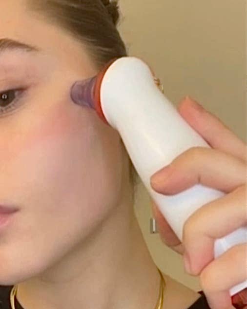 DermaTech Skincare - Wholesale Electronic Skincare Device - Microdermabrasion Skin Rejuvenation Kit2