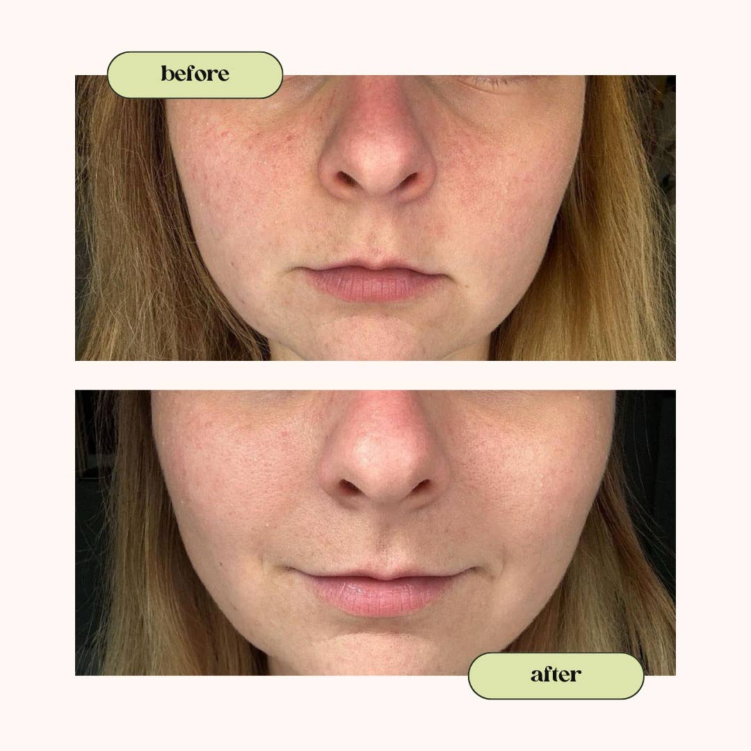 Dahlia Skincare - Wholesale Facial Moisturizer - Blueberry & Matcha Facial Moisturizer4