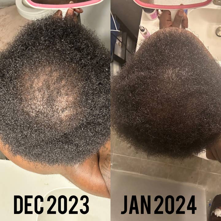 SKYN FLUENT - Wholesale Scalp/Hair Treatment - Low Porosity Leave-In Dried Hibiscus, Cloves, Hair Tonic