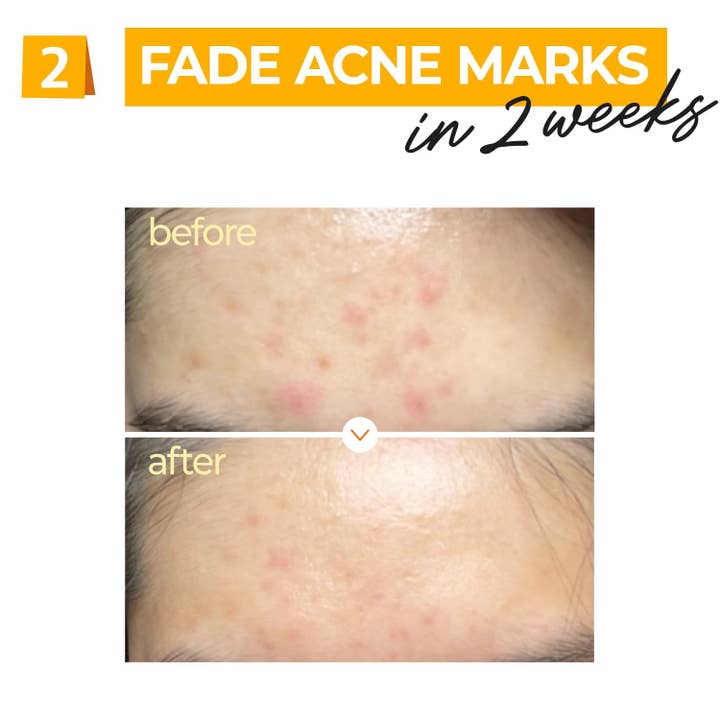 Glowiss - Vente Concentré/sérum pour le visage - Sérum concentré vitaminé NUMBUZIN No.5 30 ml2