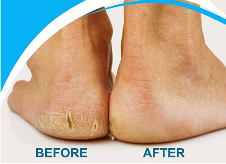 Dangles Bangles More Co - Wholesale Electronic Skincare Device - Nature Tech Wet/Dry Cordless Callus Remover2