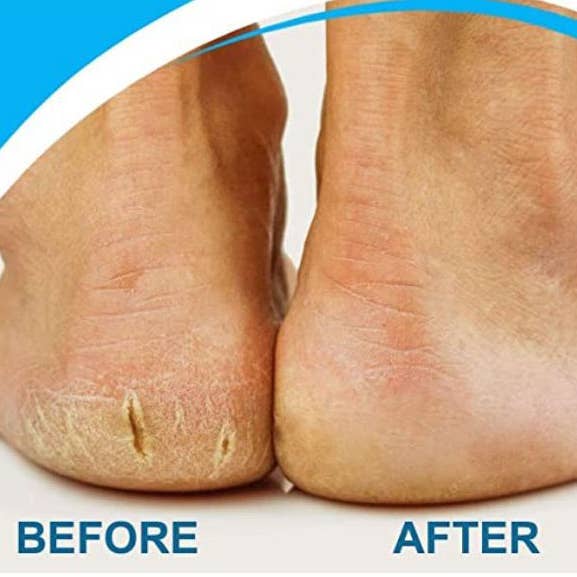 Dangles Bangles More Co - Wholesale Electronic Skincare Device - Nature Tech Wet/Dry Cordless Callus Remover2