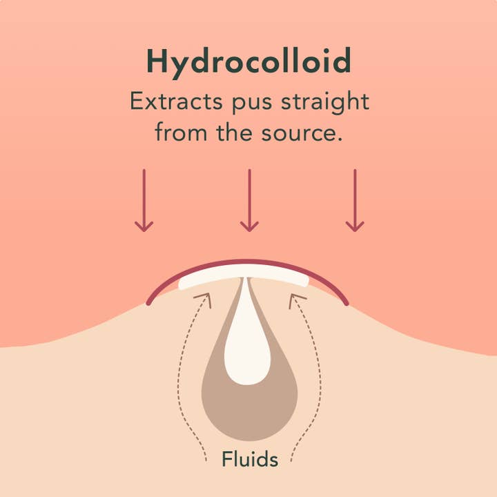 Rael - Wholesale Acne/Hydrocolloid Patch - Rael Miracle Patch Invisible Spot Cover - Pimple Patch, Acne3