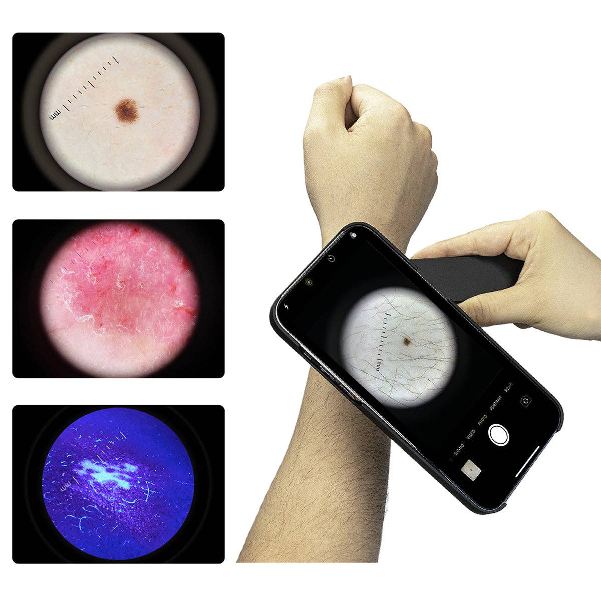 IBOOLO - Wholesale Electronic Skincare Device - IBOOLO DE-4100 PRO functional handheld brightness adjustment dermatoscope for naked eye examine1