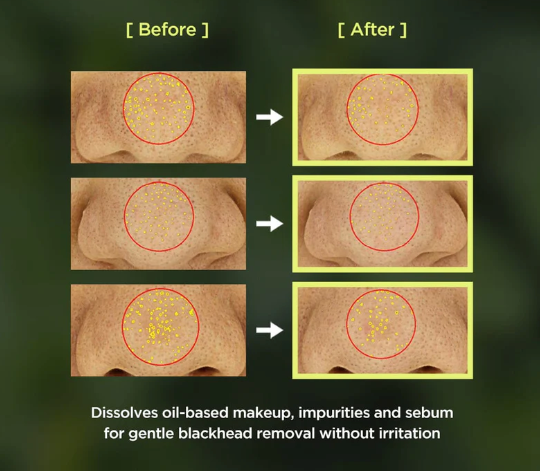 Best Beauty Group - Wholesale Facial Cleanser - ANUA Heartleaf Pore Control Cleansing Oil4