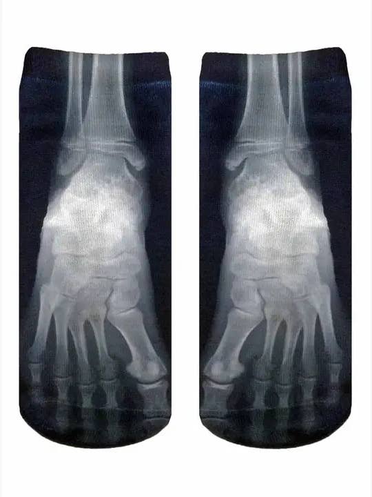 Novelty Graphic Ankle Socks - X-Ray of Foot Bones - Black for wholesale by Living Royal
