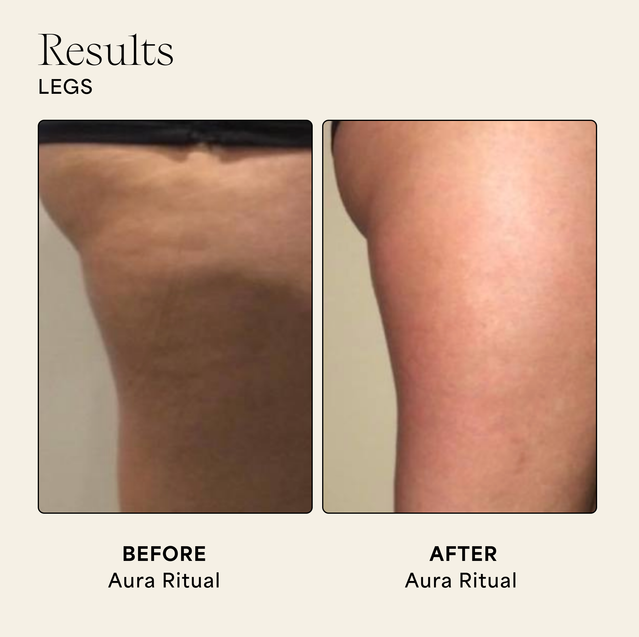 Wildling - Vente Gua Shas - Pierre d'aura3