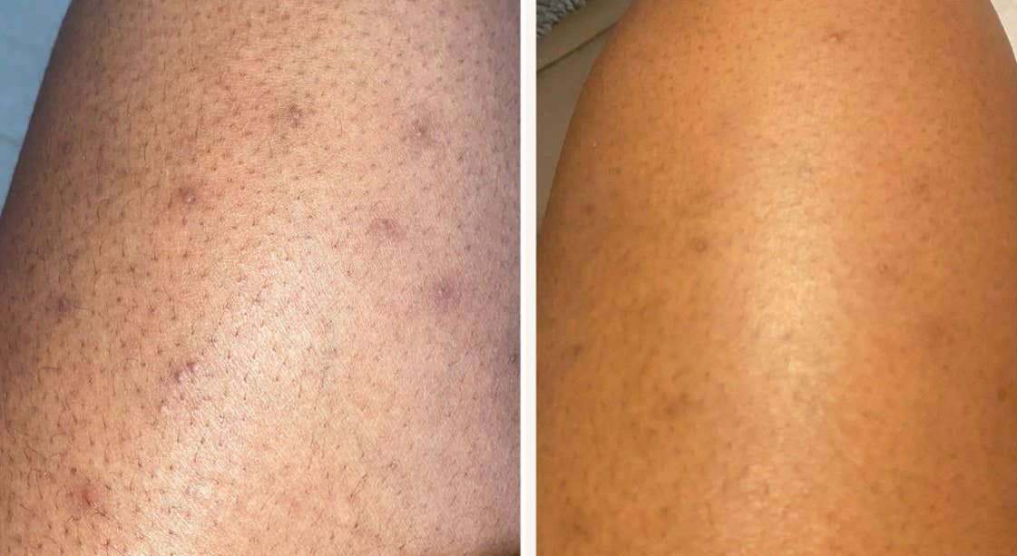 Care2glow - Wholesale Body Scrub/Exfoliant - Turmeric Body Scrub4