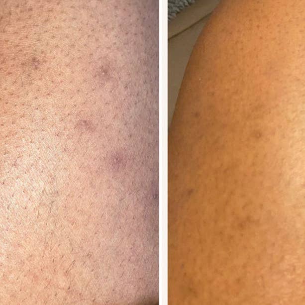 Care2glow - Wholesale Body Scrub/Exfoliant - Turmeric Body Scrub4