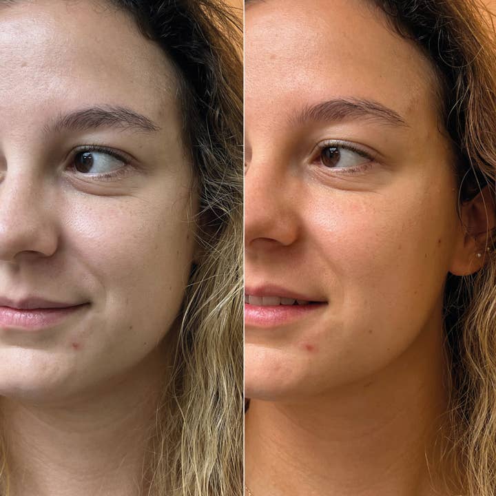 Comme Avant - Wholesale Facial Serum/Concentrate - High-concentration serum with an immediate healthy glow2