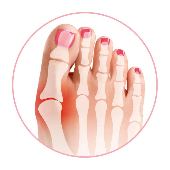 GoBunion – Engroshandel Strømper - Dame – GOBunion Hallux sokker med integreret tåspreder1