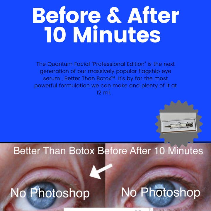 NABulous - Wholesale Anti-aging moisturiser - Better than Botox™ Anti-Aging Serums Under Eye Wrinkles, Forehead and Professional Edition42