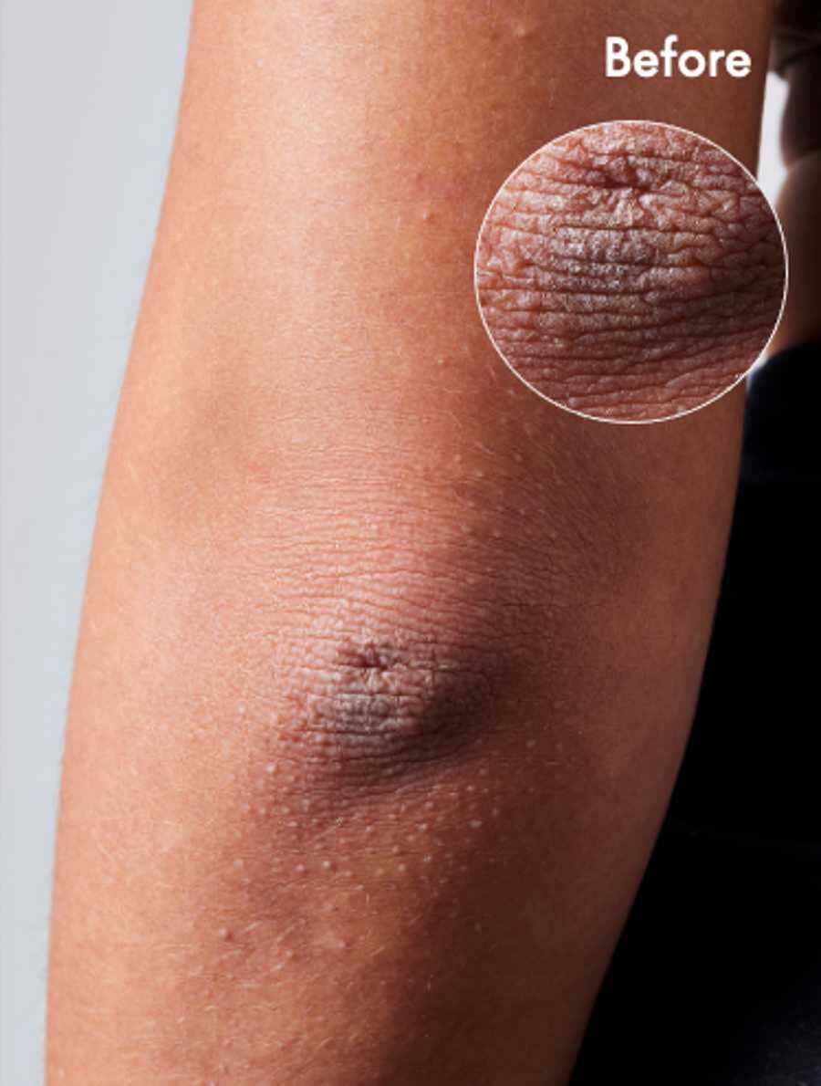 Lanolips - Wholesale Body Cream/Lotion - 101 Dry Skin Super Cream - Multipurpose For Face + Body9