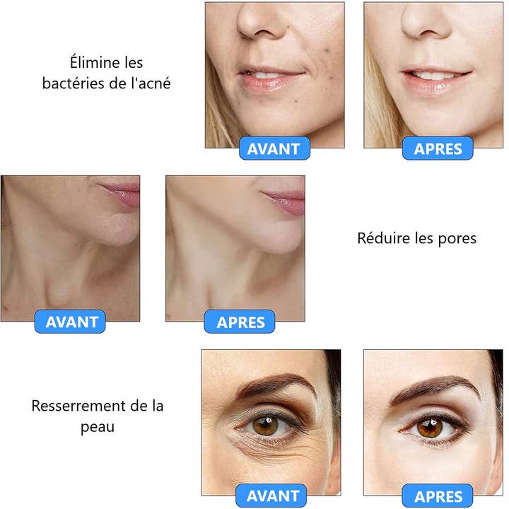 PALOMA BEAUTIES - Wholesale Electronic Skincare Device - ANTI IMPERFECTION PEN3