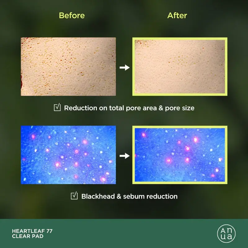 Best Beauty Group - Wholesale Facial Toner - ANUA Heartleaf 77% PHA Toner Pad (70 Pads)4