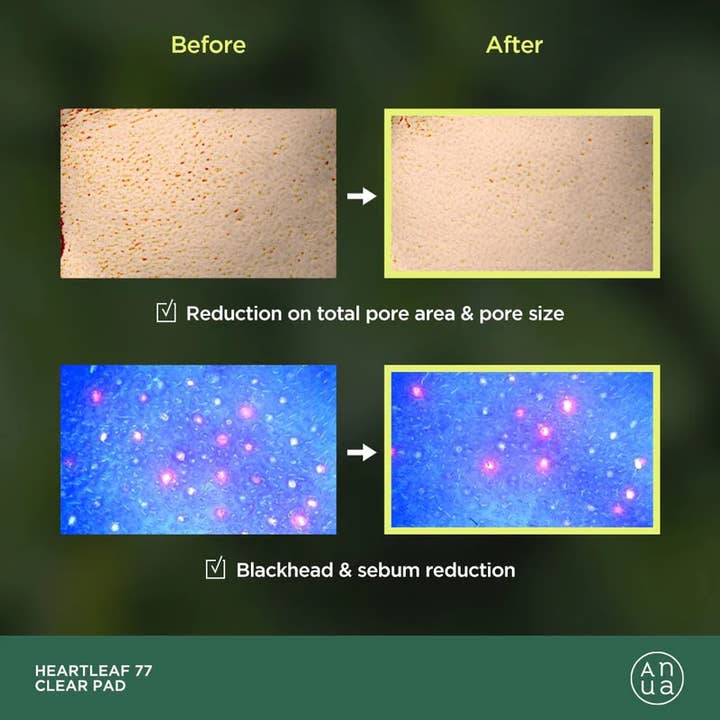 Best Beauty Group - Wholesale Facial Toner - ANUA Heartleaf 77% PHA Toner Pad (70 Pads)4