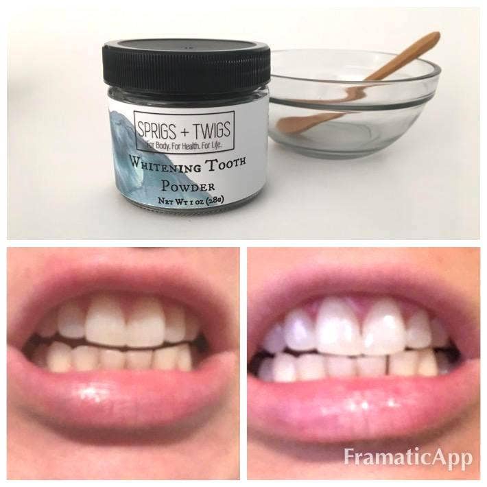 Teeth Whitening Tooth Powder Kit for wholesale by Sprigs + Twigs
