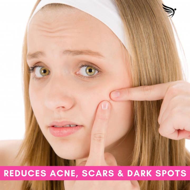 Moksha Beauty - Wholesale Bar Soap - Sulphur Soap for Acne, Mites, Scabies, Anti-Blemish Soap2