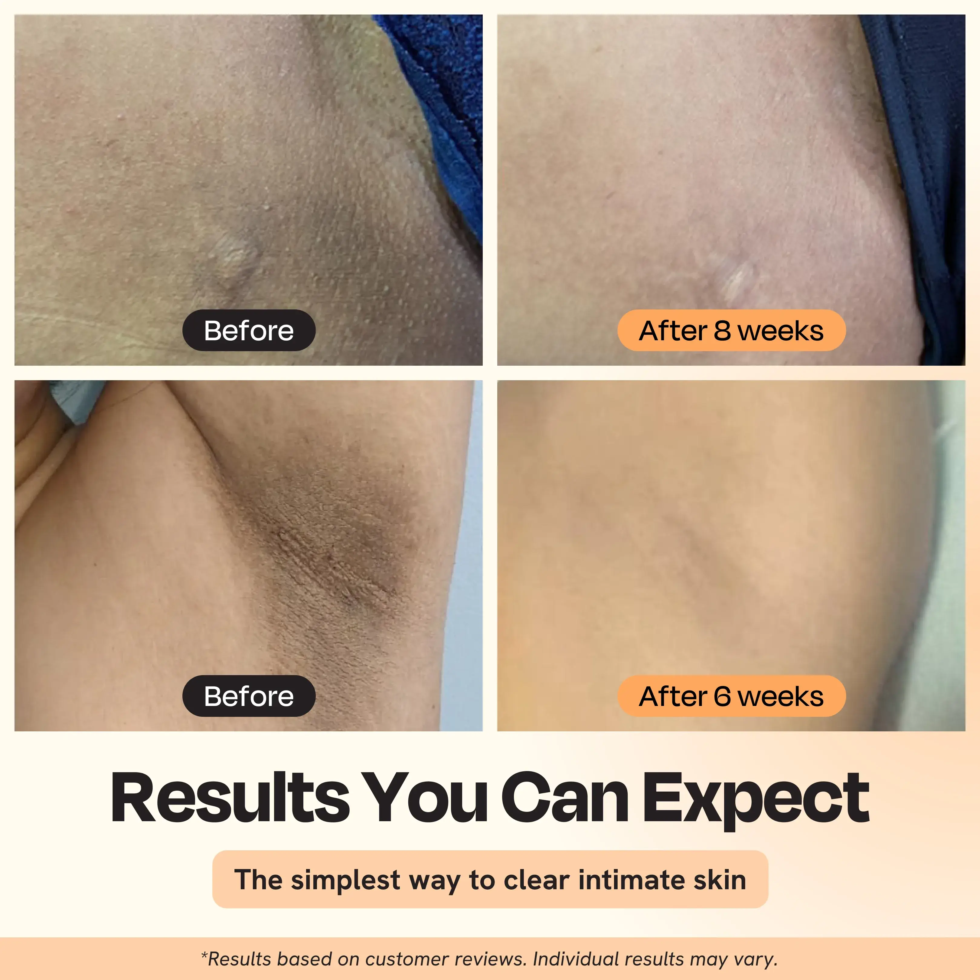 Gleamin - Wholesale Intimate Cleanser/Wipe - Illuminating Intimate Serum
3