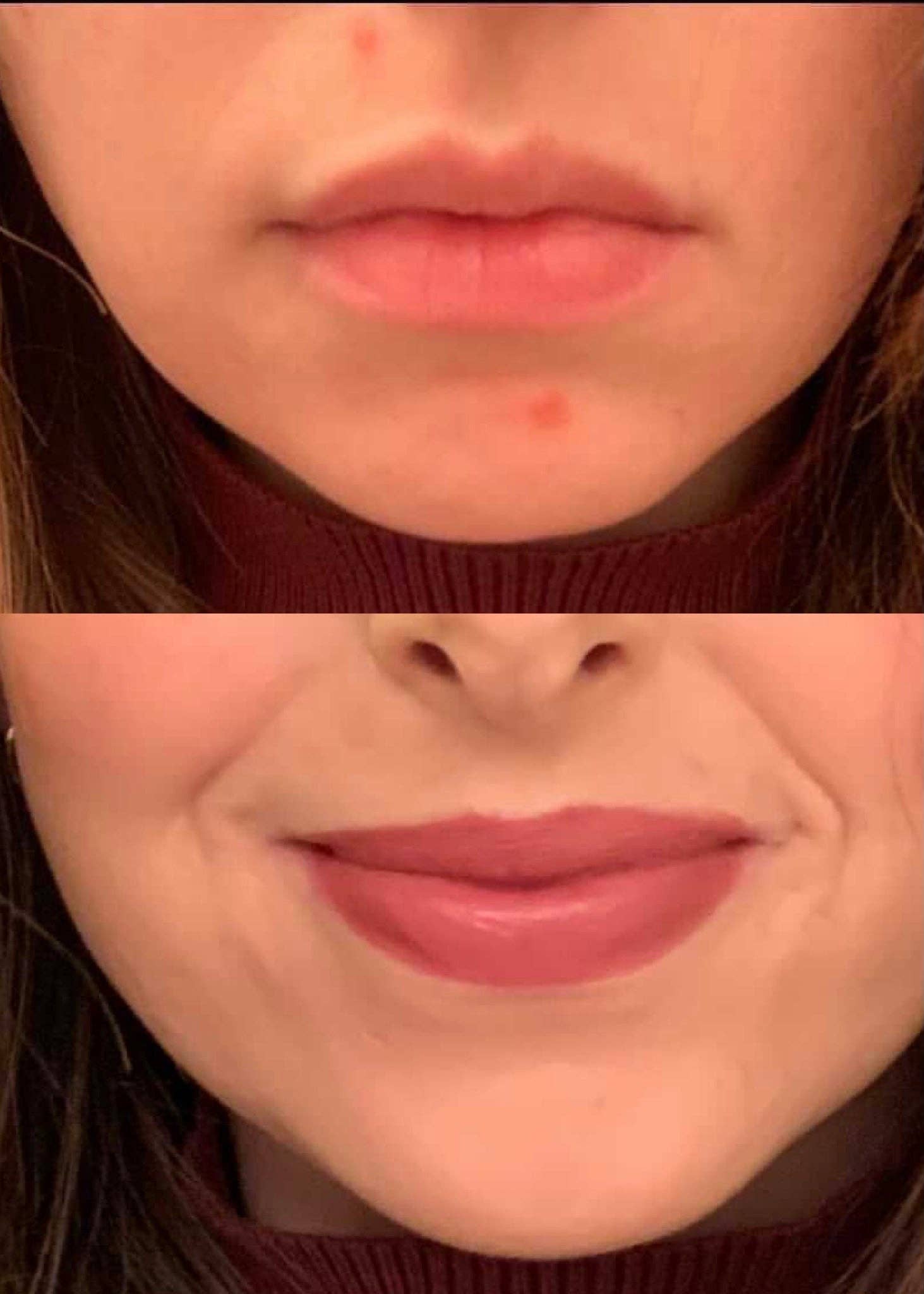 August & Monroe, Inc - Wholesale Acne/Hydrocolloid Patch - 3-IN-1 BLEMISH CAMOUFLAGE2