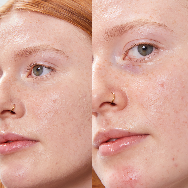 PURE U. - Wholesale Face Concealer - CONCEALER BALM | Natural Cosmetics | Vegan |5