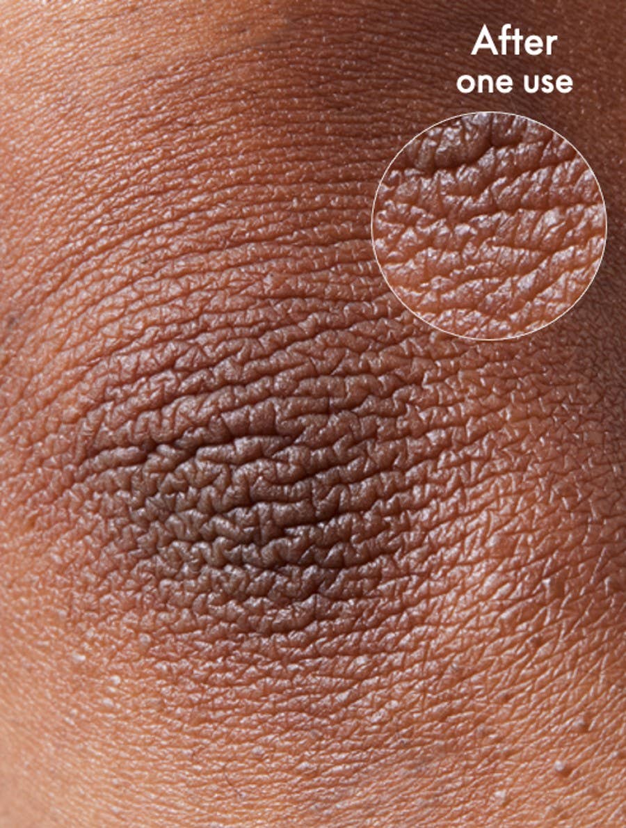 Lanolips - Wholesale Body Cream/Lotion - 101 Dry Skin Super Cream - Multipurpose For Face + Body8