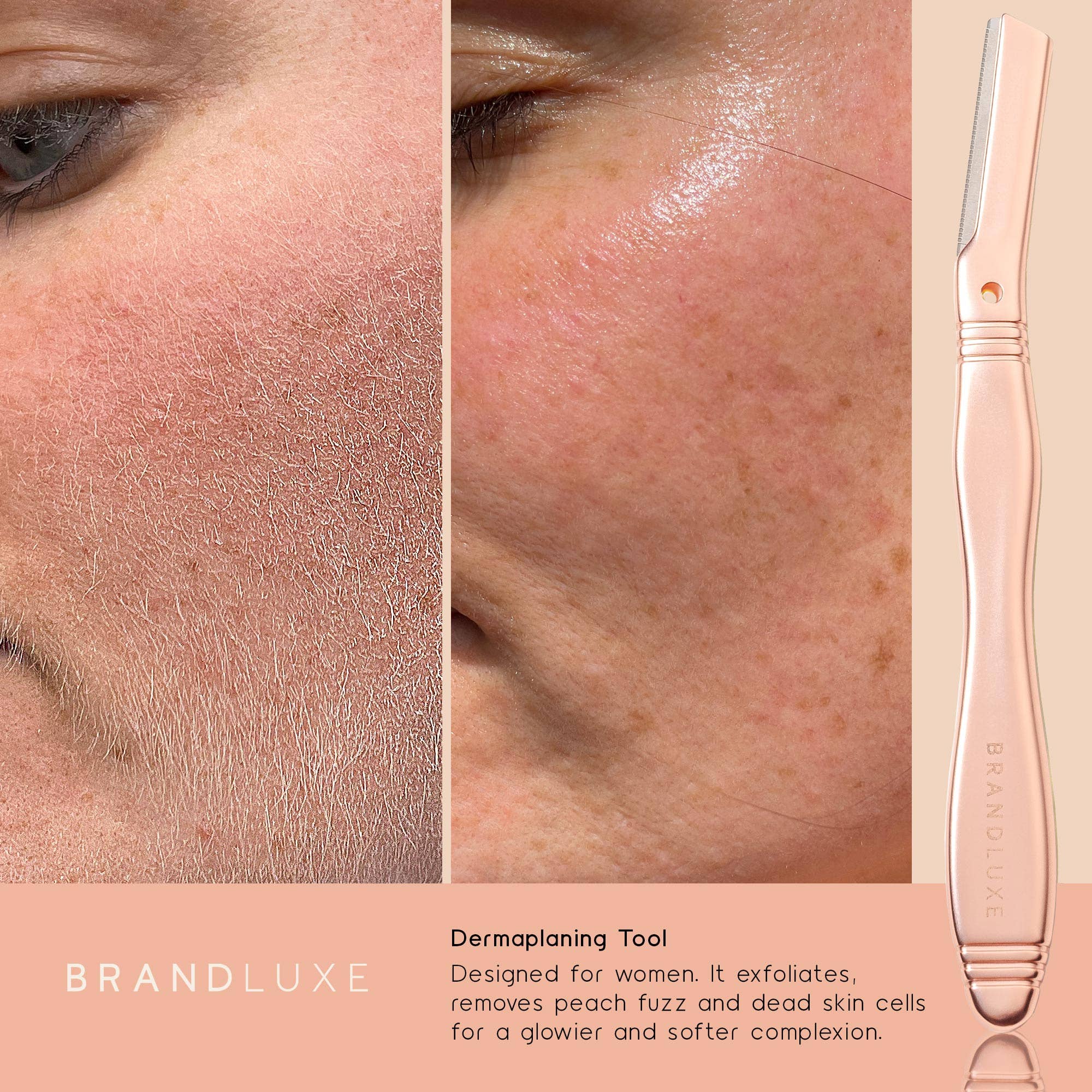 Talika – wholesale Electronic skincare device – Brandluxe Dermaplaning Tool5