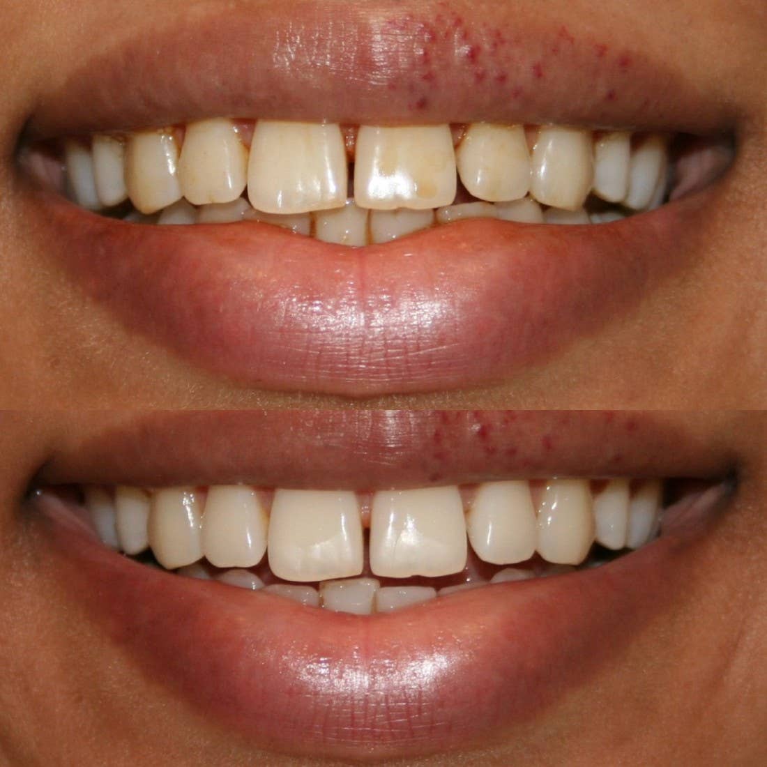 Smile Science Harley Street - Wholesale Teeth Whitener - Smile Science Teeth Whitening Kit7