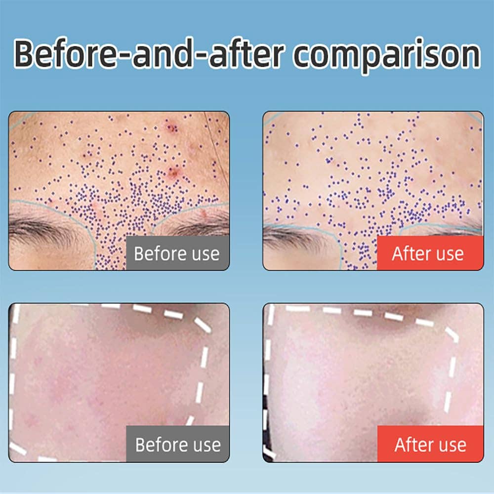 VIGOR - Wholesale Skincare Face Mask - Ice Cooling Mask Near Infrared LED Face Red Light Therapy3