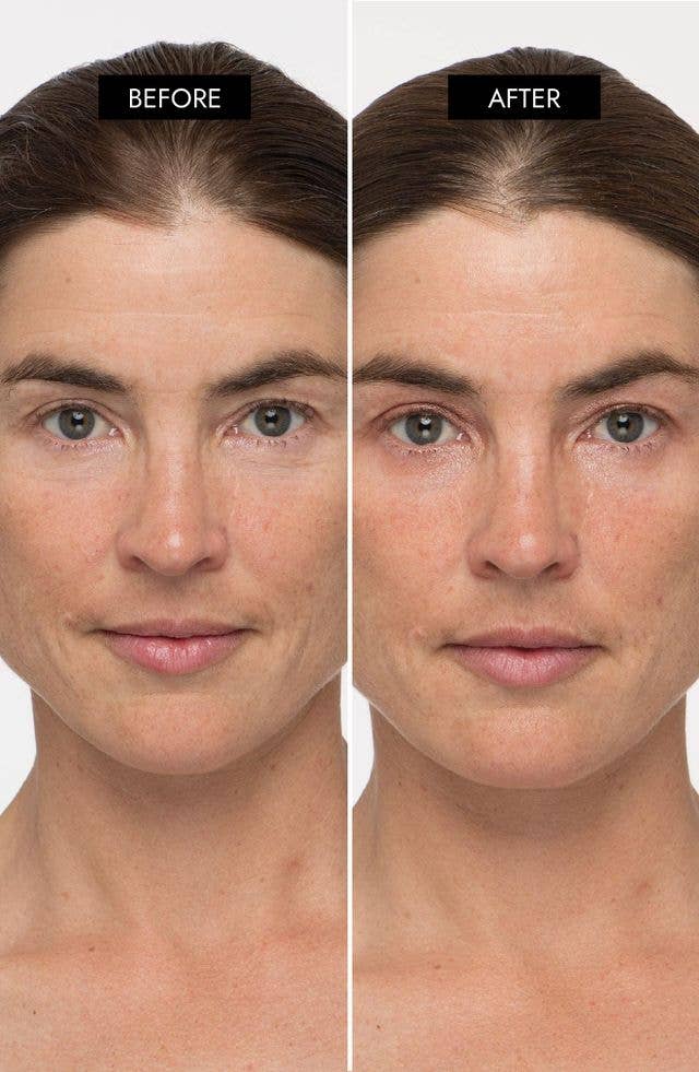 7e Wellness - Wholesale Electronic Skincare Device - 7e MyoLift Triwave Microcurrent Device4