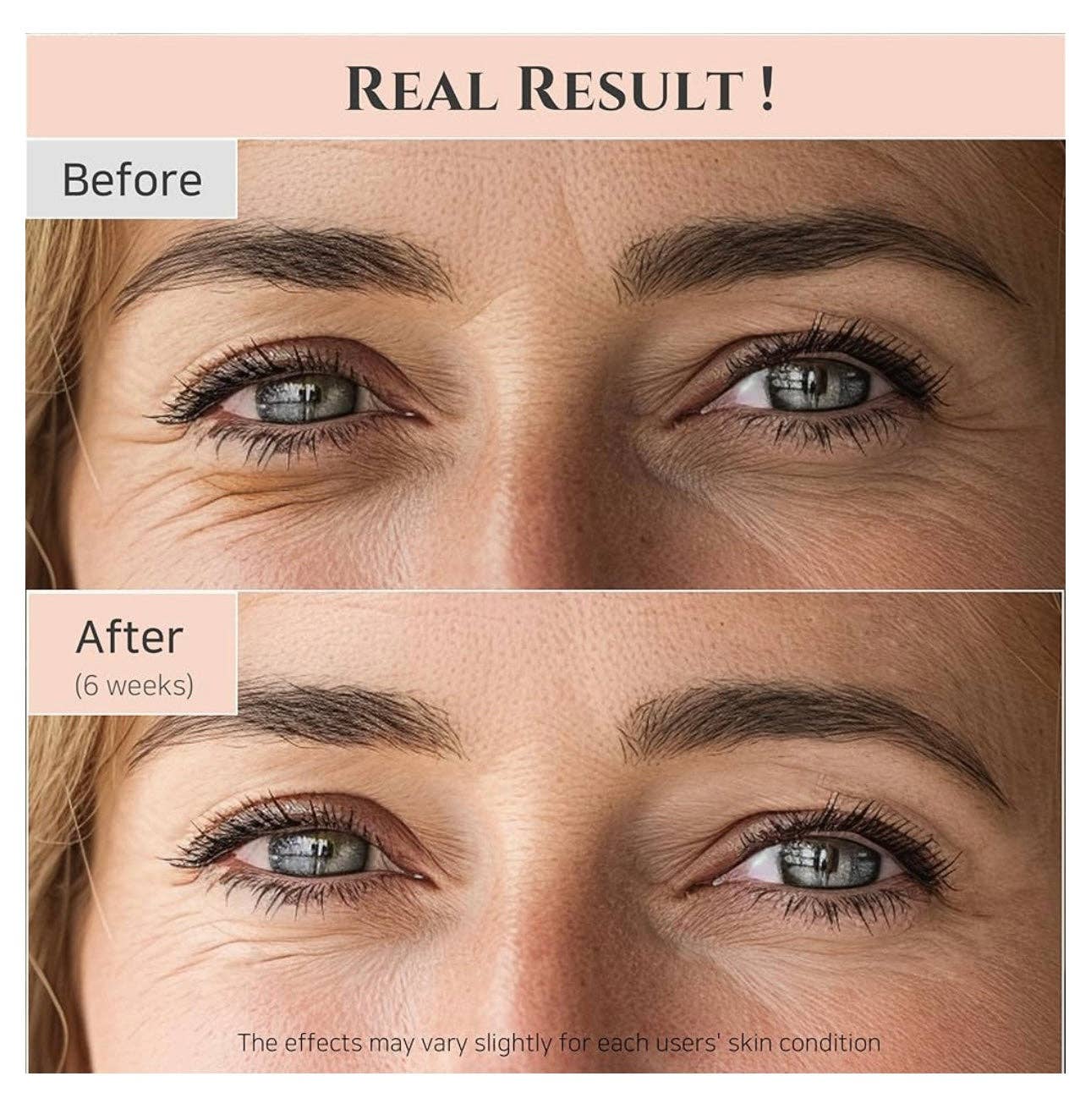 Beauty of Joseon, ANUA, COSRX, SKIN1004, Lilyfield - Wholesale Eye Serum - Beauty of Joseon Revive Eye Serum : Ginseng + Retinal 30ml5