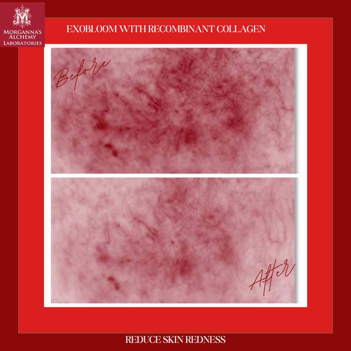 Morganna's Alchemy - Wholesale Anti-Aging Moisturizer - Morganna’s ExoBloom™ – Advanced Repair Gel with Plant Exosom3