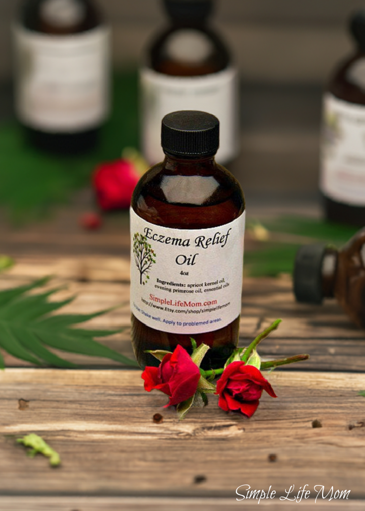 Simple Life Mom - Wholesale Bath/Body Oil - ECZEMA RELIEF OIL - 4oz soothe irritated, dry skin, organic body oil with essential oils, dermatitis oil4