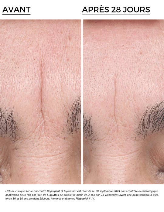 DERMEDEN – Engroshandel Ansigtsserum – Fugtgivende og opstrammende koncentrat 15 %2