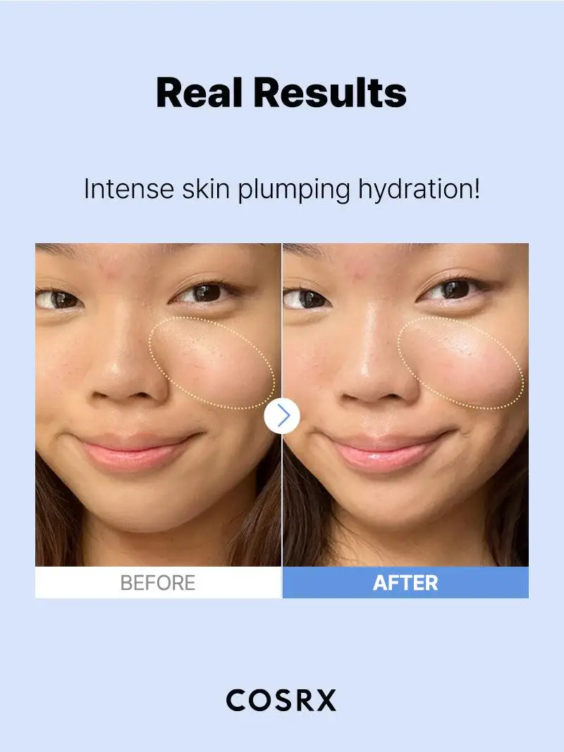 Kosmic - Kbeauty Skincare - Wholesale Facial Serum/Concentrate - [COSRX] THE HYALURONIC ACID 3 SERUM 20ML7