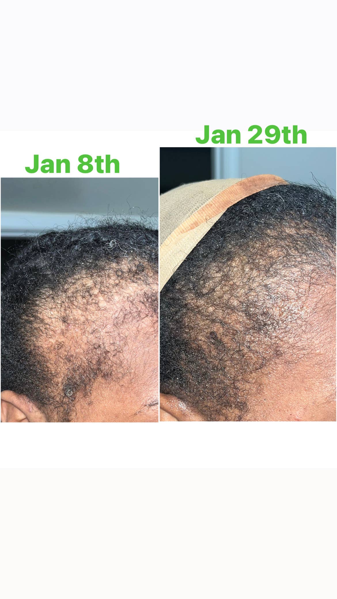 Unique Organics Haircare - Venta al por mayor Aceite capilar - Aceite para el cabello con 40 ingredientes contra la alopecia3