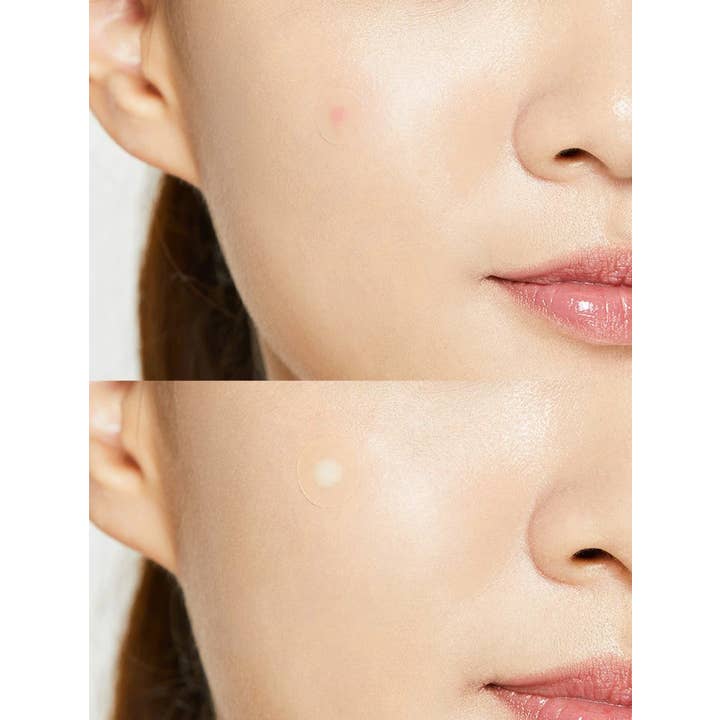 Best Beauty Group - Wholesale Acne/Hydrocolloid Patch - COSRX Acne Pimple Master Patch kbeauty