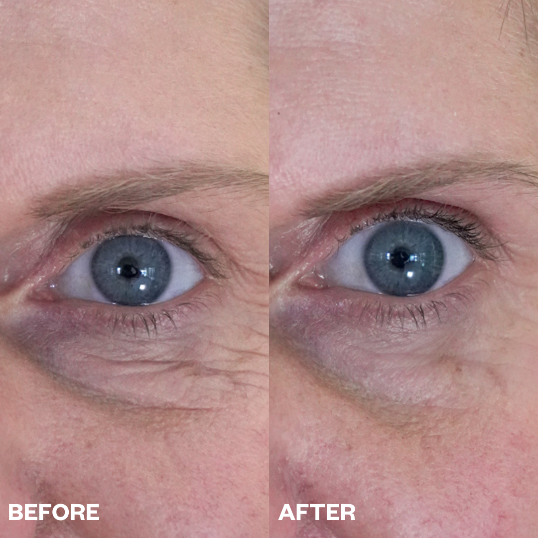 Abundance Naturally Ltd. - Wholesale Eye Treatment Mask - Wrinkles Schminkles | Eye Wrinkle Patches3