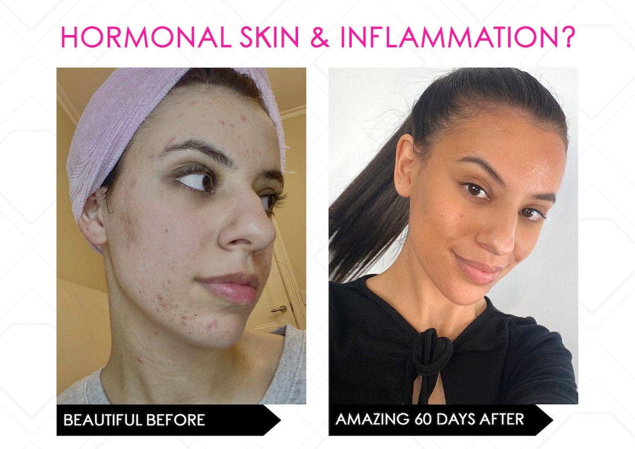 Mirenesse - Wholesale Electronic Skincare Device - LED Multi Light Therapy Mask, Electronic Skincare Device14