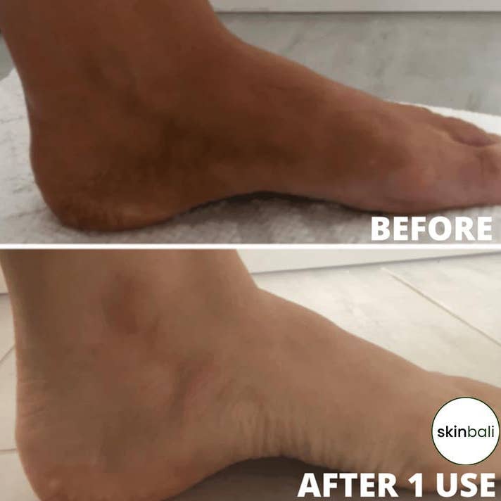 Skinbali Rituals - Venta al por mayor Guantes/manoplas exfoliantes - Guante exfoliante vegano5