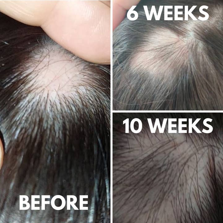 Hair Loving - Wholesale Head Scratcher/Massager - Derma Roller4