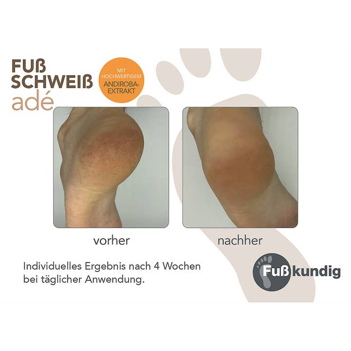 Fußkundig – Großhandel Fußcreme – Fußschweiss Adé Pflegeschaum 150ml
