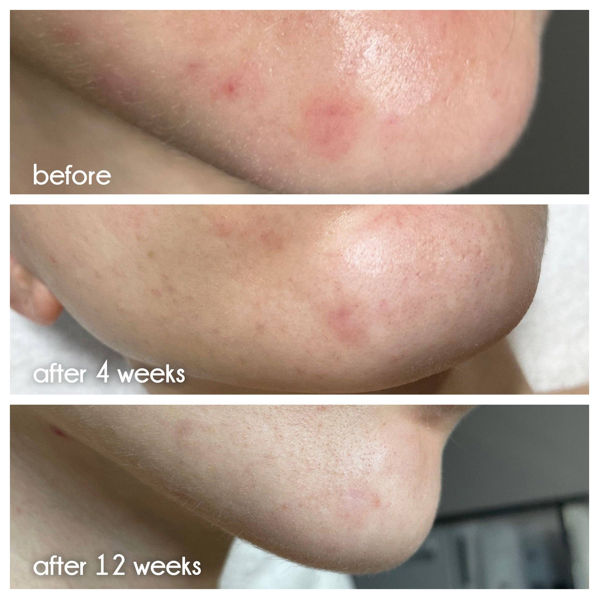 >beauty - Wholesale Facial Serum/Concentrate - Clean Slate Serum4